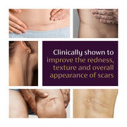 Mederma Advanced Scar Gel 1 x Daily Reduces The Appearance of Old New Scars #1 Doctor Pharmacist Recommended Brand for Scars 1,76 oz, Clear, 100 g (2 x 50 g)